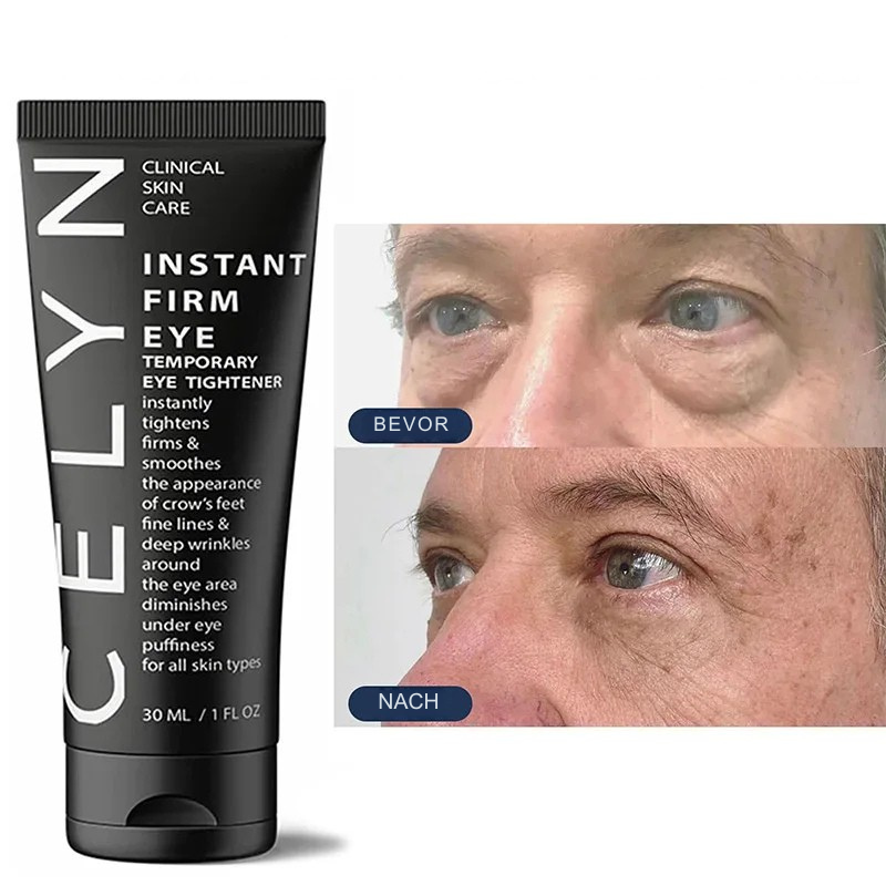 Celyn™ | Faltenfrei und straff in Sekunden