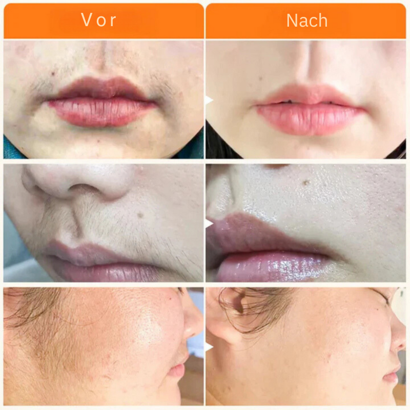 HairVanish™ | 100% Natürliche Inhaltsstoffe!
