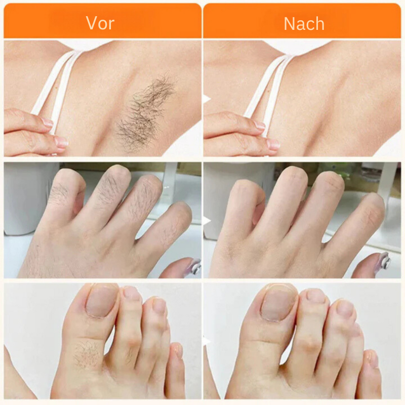 HairVanish™ | 100% Natürliche Inhaltsstoffe!