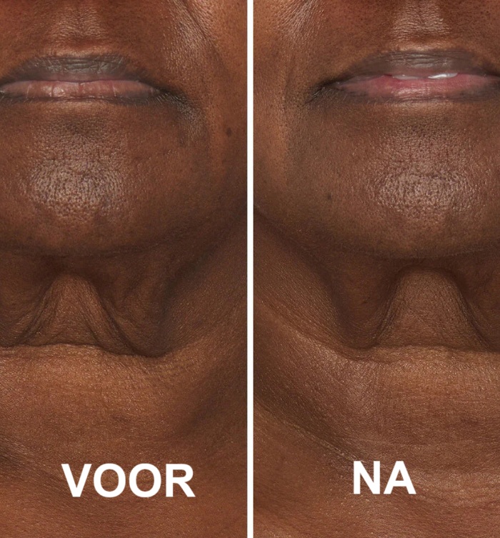 RevitaFirm™ | Für eine jugendliche, straffe Haut!