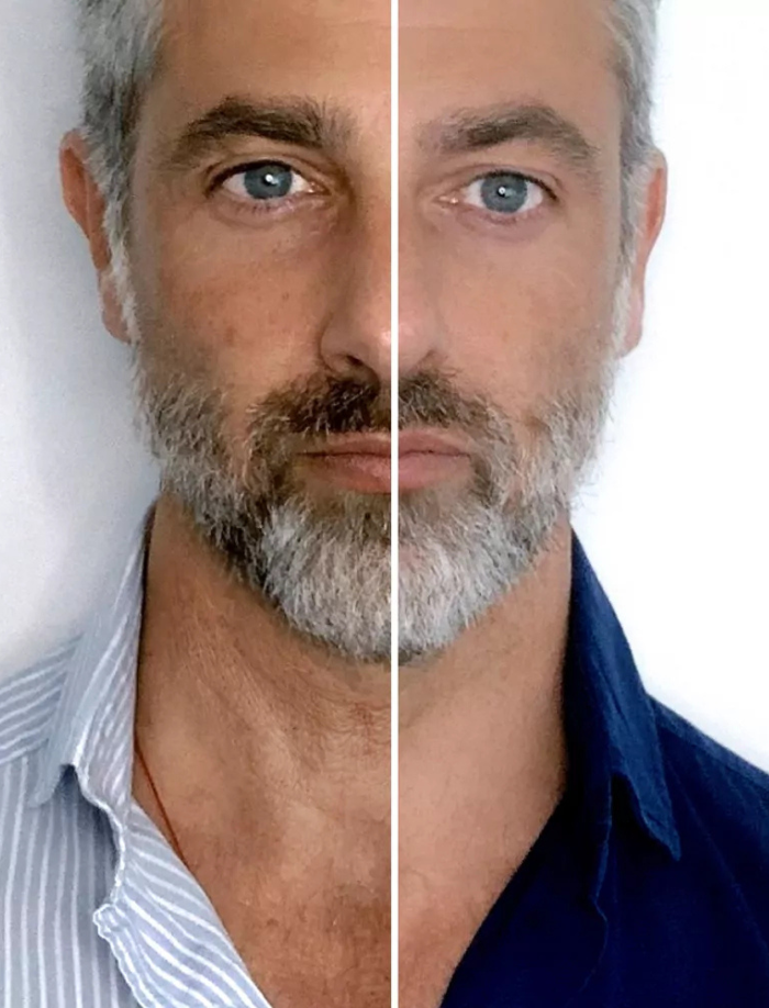 RevitaFirm™ | Für eine jugendliche, straffe Haut!