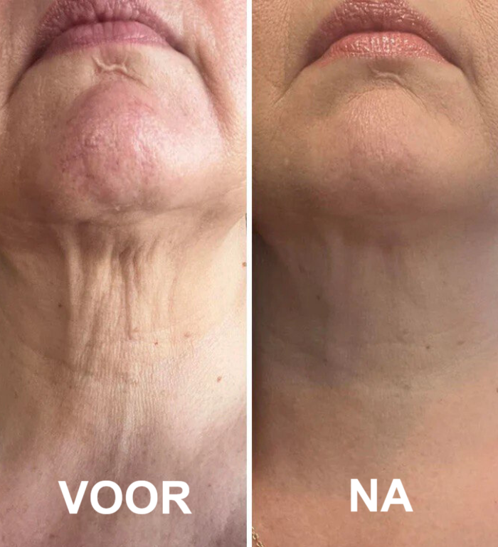 RevitaFirm™ | Für eine jugendliche, straffe Haut!