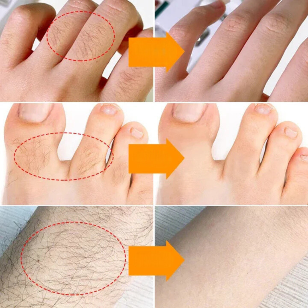 HairVanish™ | 100% Natürliche Inhaltsstoffe!