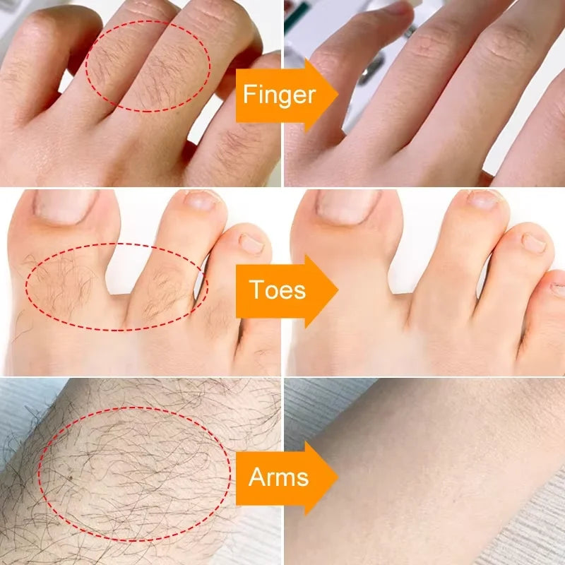 Silkura™ | 100% Natürlich!