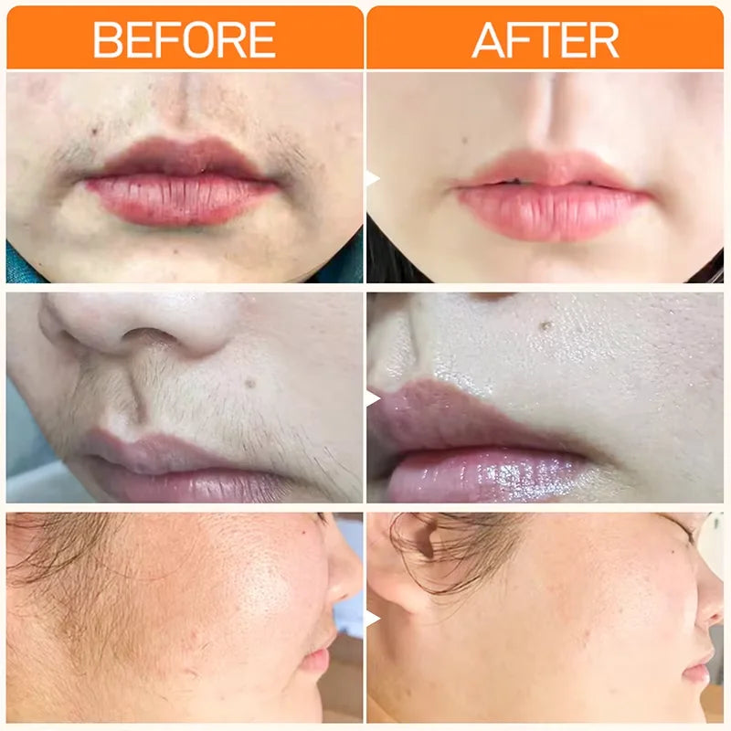 Silkura™ | 100% Natürlich!