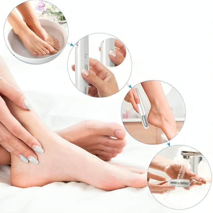 SoftFeet™ | Sofort weiche Füße!