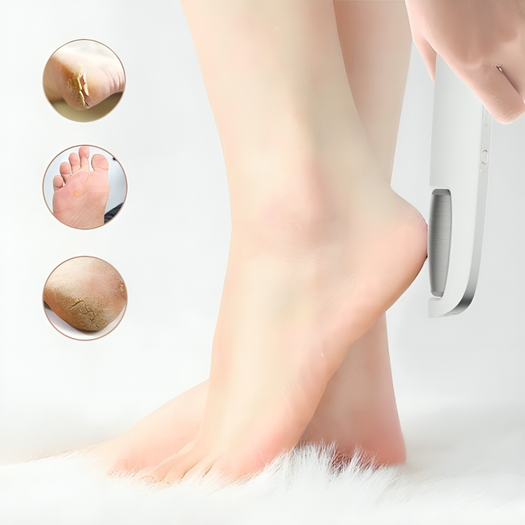 SoftFeet™ | Sofort weiche Füße!