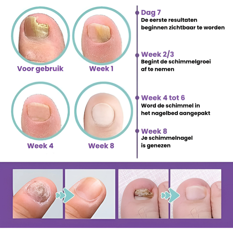 FungiCare™ | Stellt wieder her & schützt